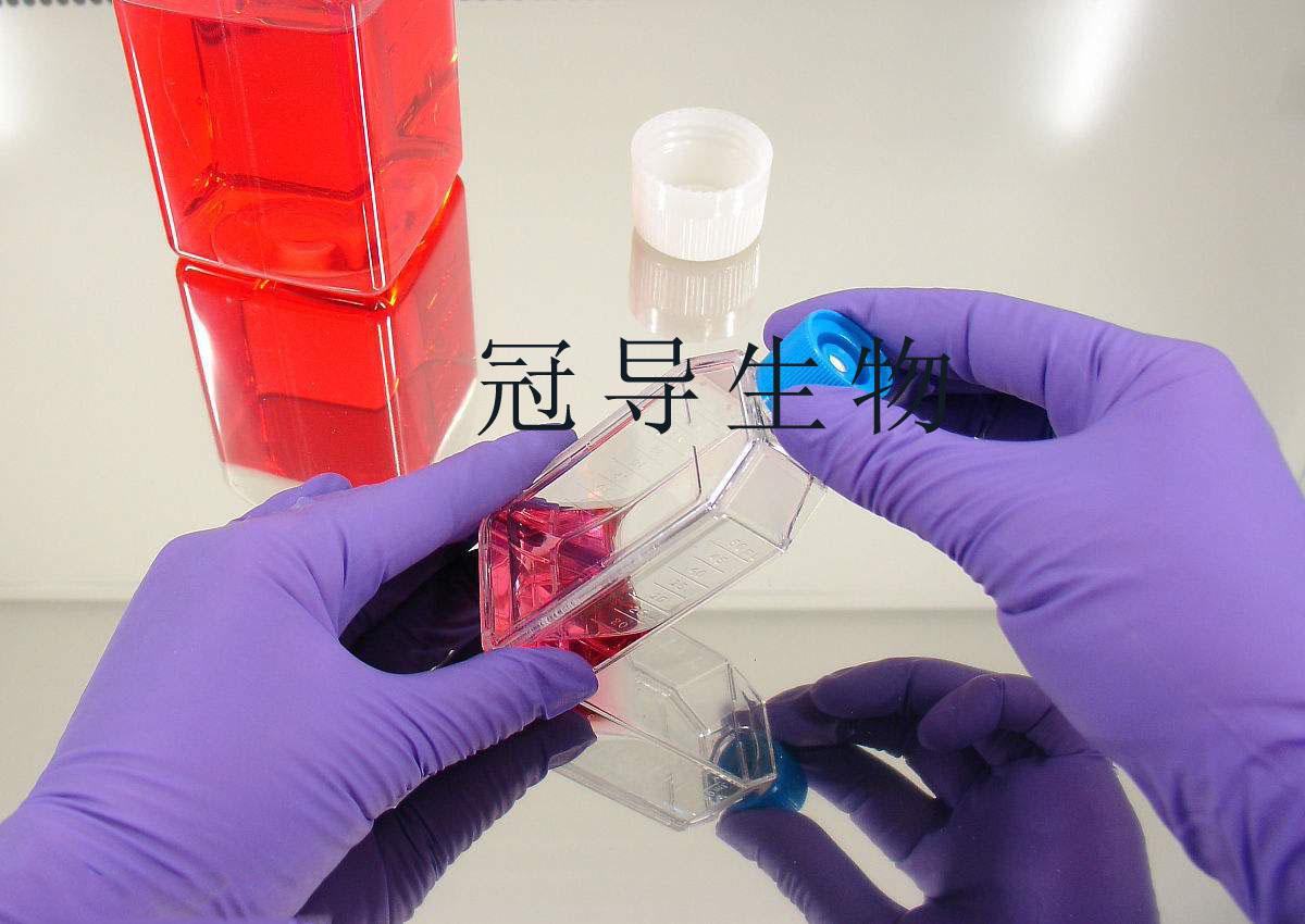 RAEC细胞系(大鼠主动脉血管内皮细胞培养操作注意事项)