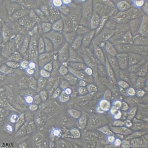 HUVEC-C  人脐静脉内皮细胞（通过STR鉴定) 