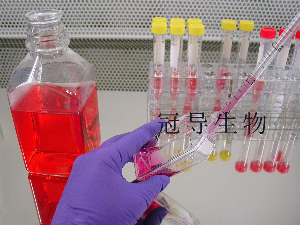 MBVP细胞|小鼠脑血管周细胞系哪家有