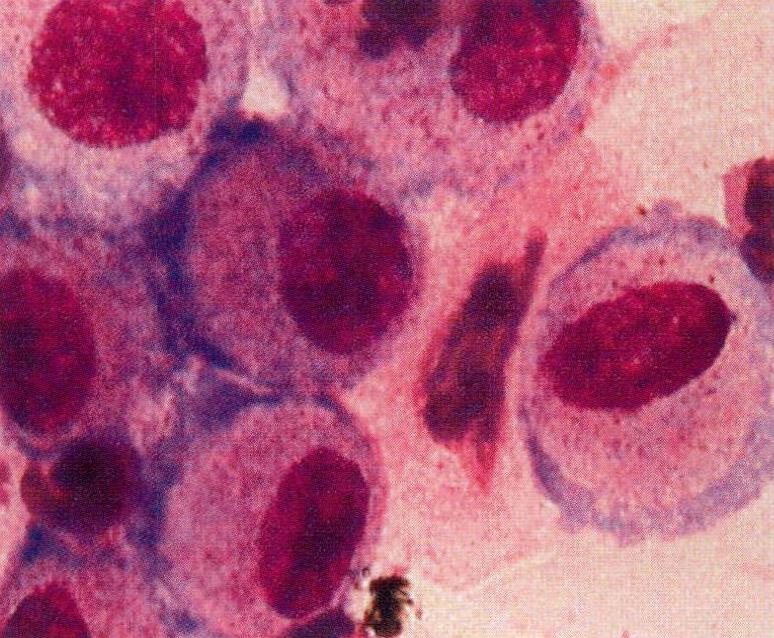 CHL(仓鼠肺细胞)图片