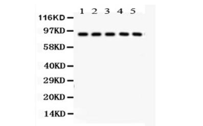 Anti-NMDA epsilon4抗体