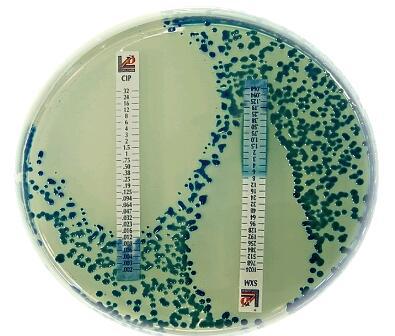 阿莫西林*-克拉维酸 (2/1)