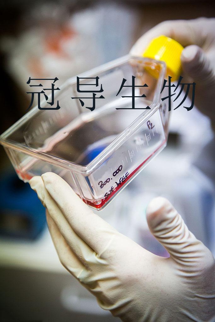 HBSMC人支气管平滑肌细胞系 要如何操作培养会更好