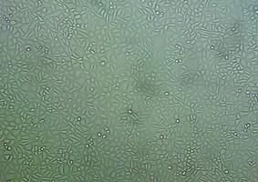 RCF大鼠心脏成纤维细胞  