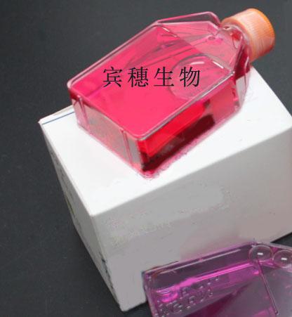 DV-90细胞：人肺癌腺癌细胞