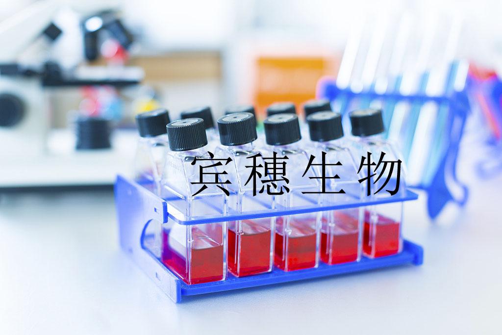 RAMOS细胞|人B淋巴细胞瘤细胞