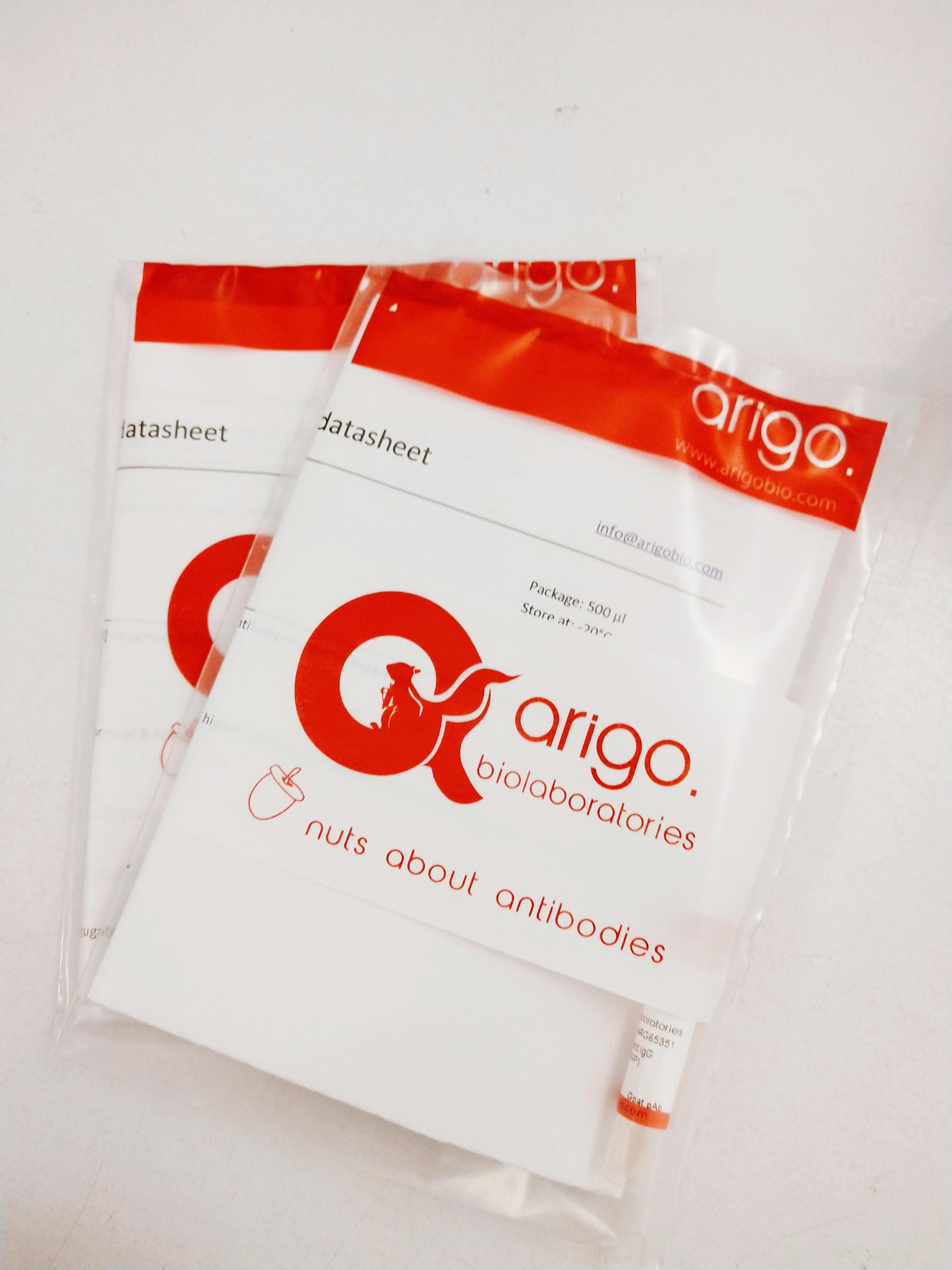 anti-Respiratory syncytial virus (RSV) Fusion Protein antibody [RSV3216 (B016)]