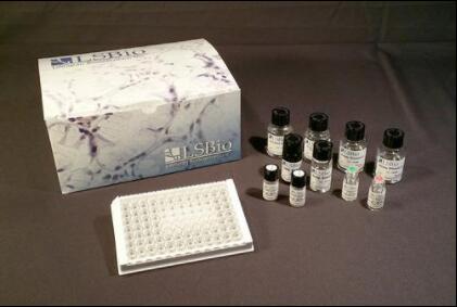 Human GC / Vitamin D-Binding Protein ELISA Kit (Sandwich ELISA) - LS-F4991