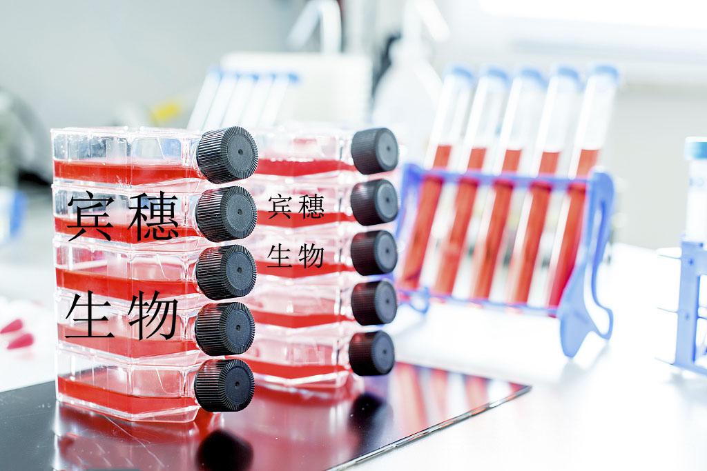 hTERT-HPNE Cell：人胰腺导管上皮细胞