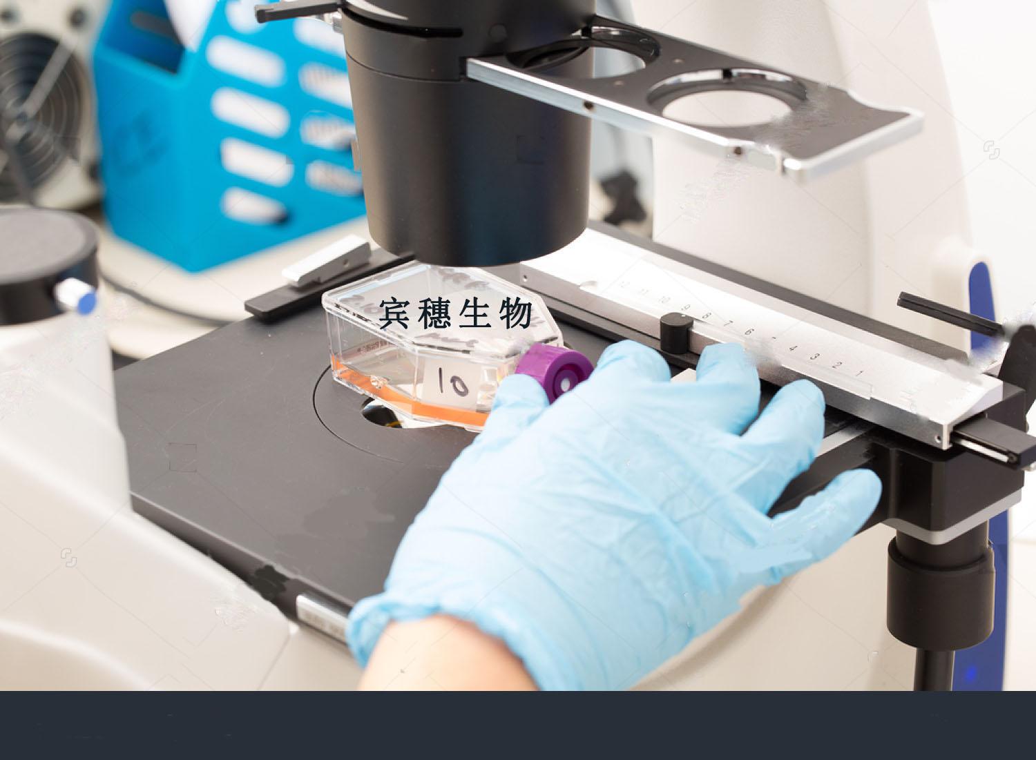 UACC812 Cell：人乳腺导管瘤细胞