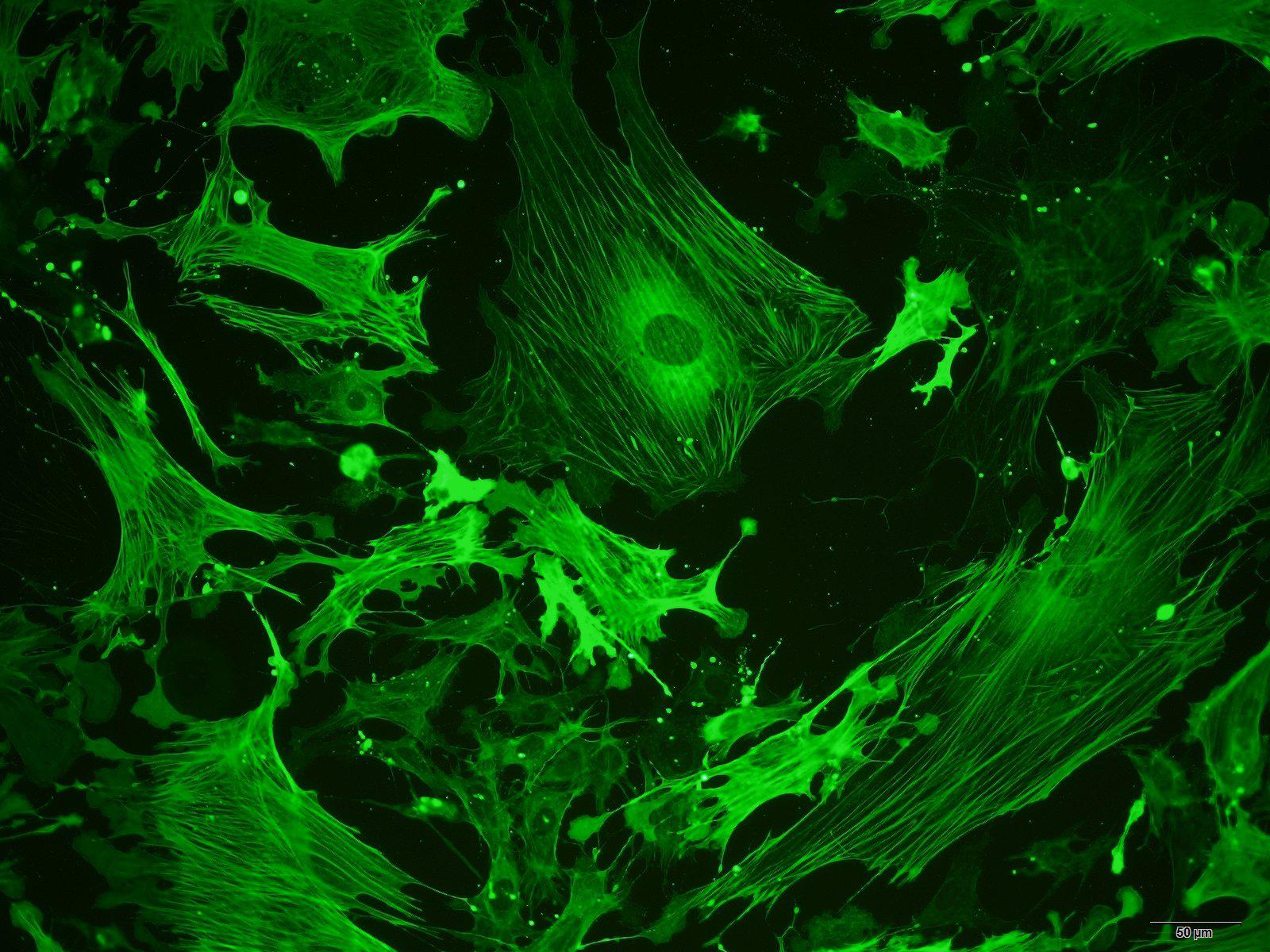 小鼠心肌成纤维细胞