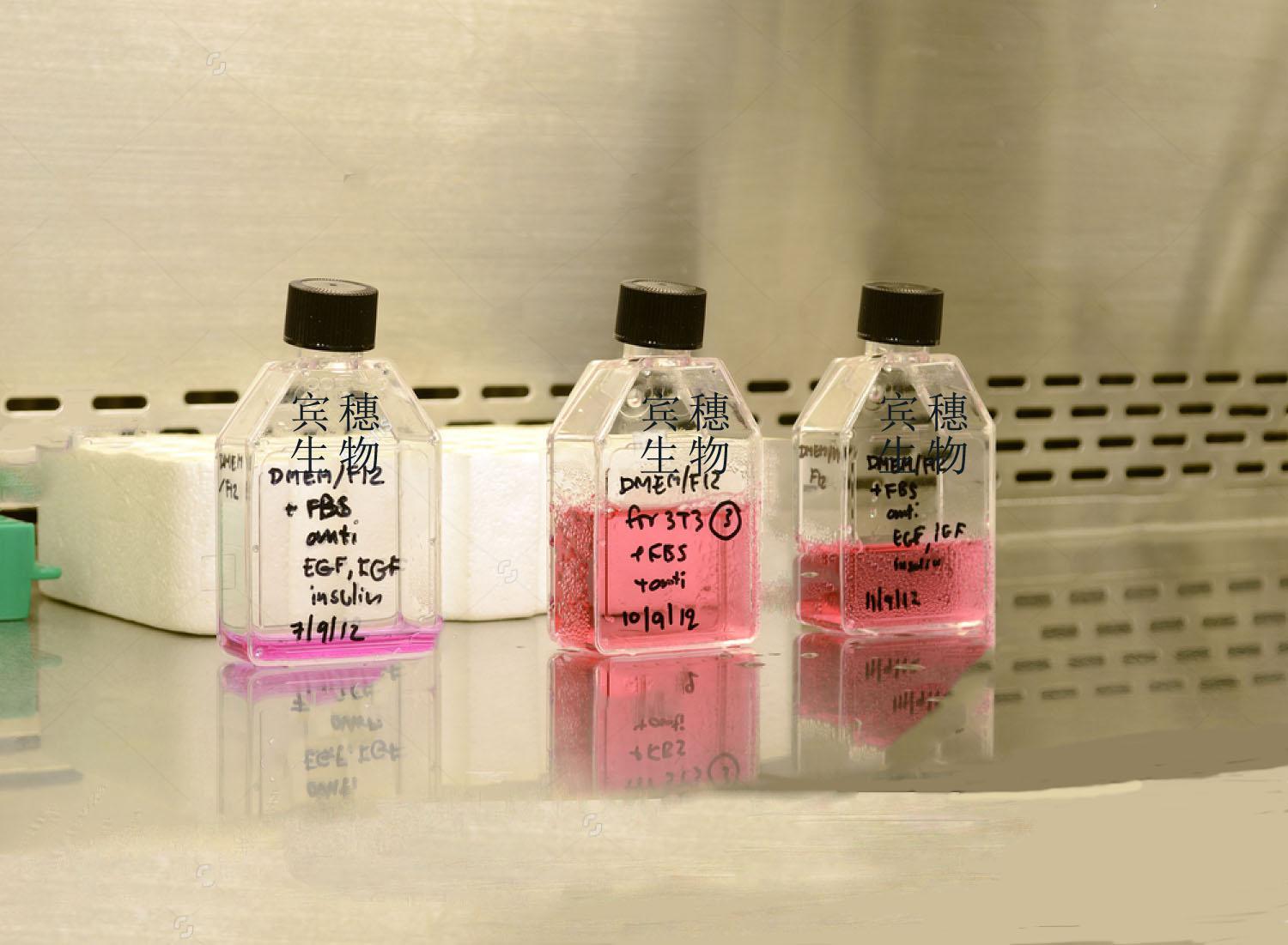 RD 人恶性胚胎横纹肌瘤细胞