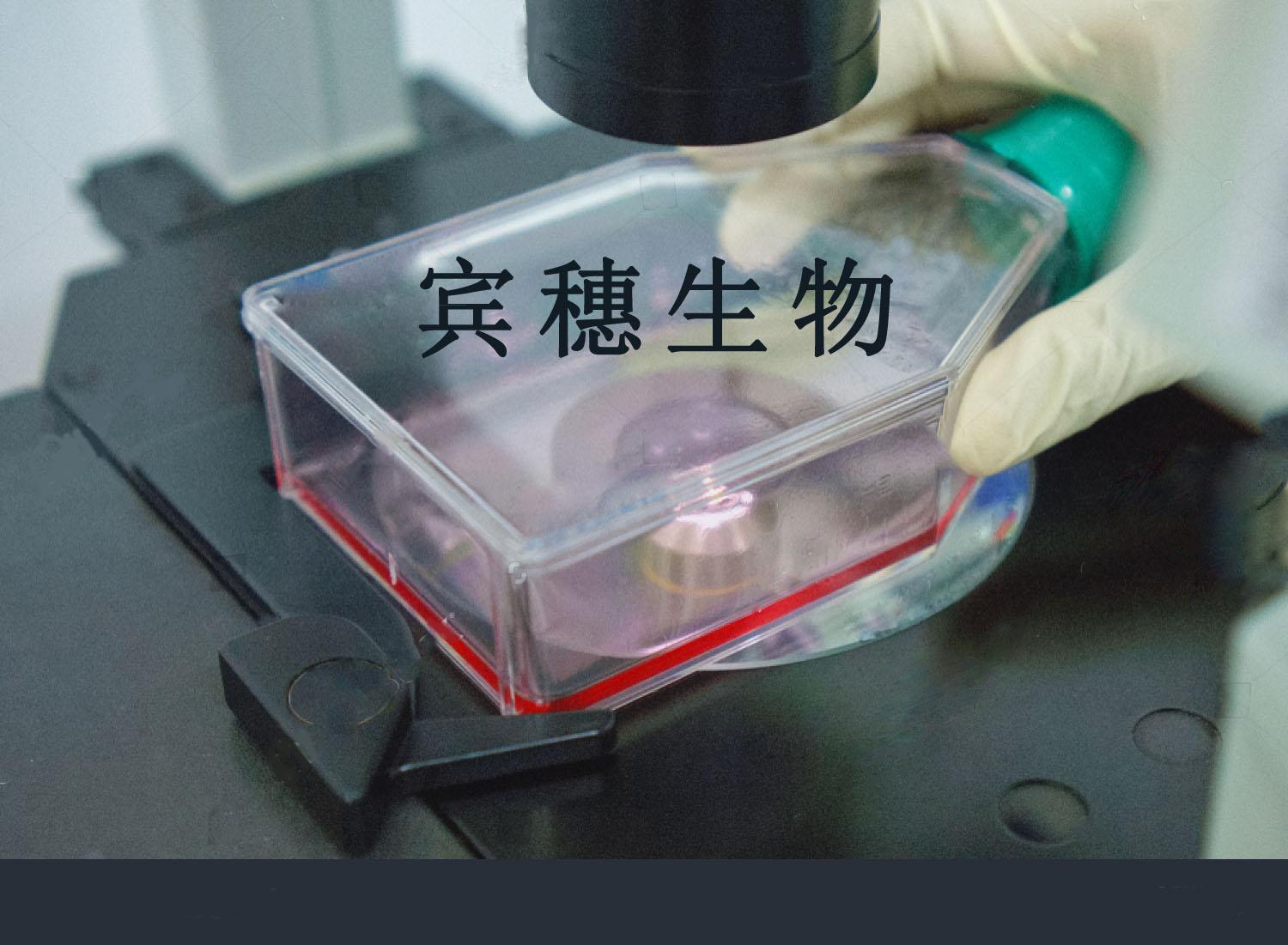 RL95-2 Cell|人子宫内膜癌细胞