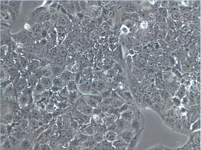 人绒毛膜癌细胞JEG-3