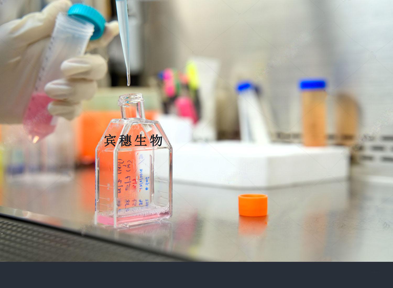 人绒毛膜癌细胞：JEG-3