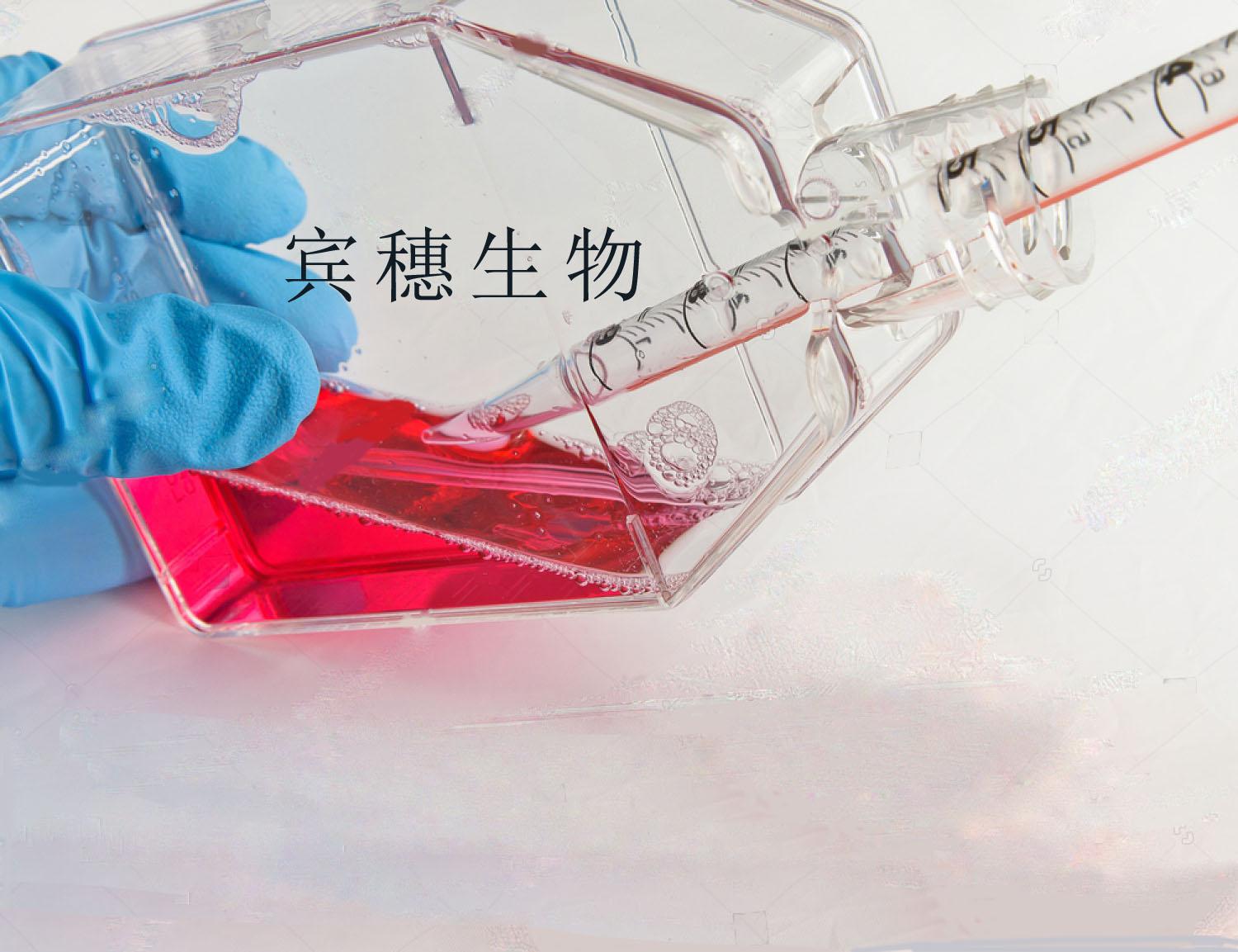 大鼠肾系膜细胞：RMC