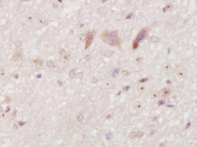 增殖细胞核抗原抗体 Anti-PCNA