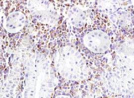 跨膜蛋白酶丝氨酸1抗体