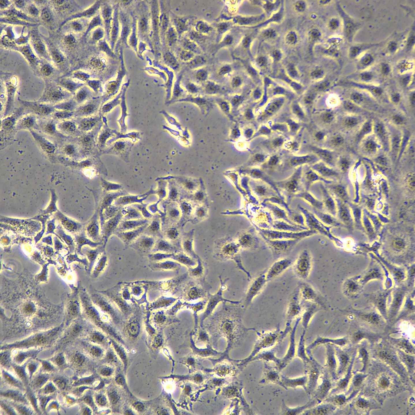 人胃黏膜上皮细胞GES-1现货