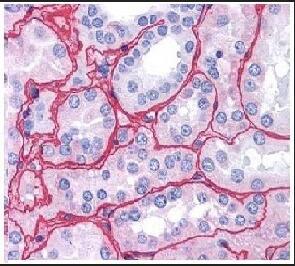 巨噬细胞炎症因子1α抗体