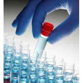 大鼠β淀粉样蛋白42(Aβ42)ELISA试剂盒