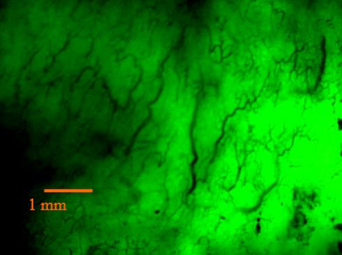 荧光肿瘤血管物模型
