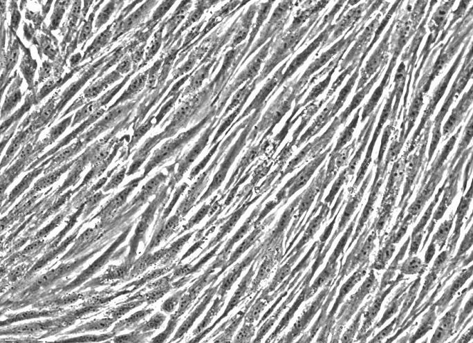 大鼠主动脉平滑肌细胞