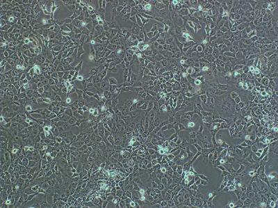 人子宫内膜腺癌细胞(HEC-1-B)
