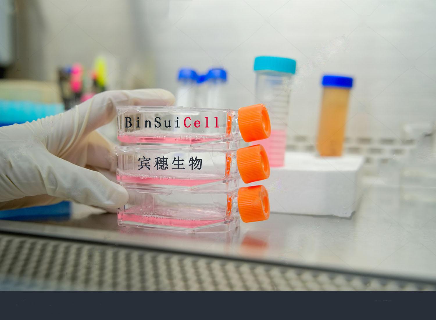 HMC细胞<人肾小球系膜细胞>