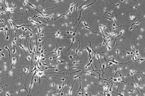 Ca Ski（人宫颈癌肠转移细胞/人宫颈癌上皮细胞）(通过STR鉴定)