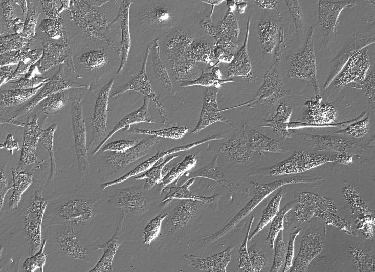 H4人脑神经胶质瘤细胞