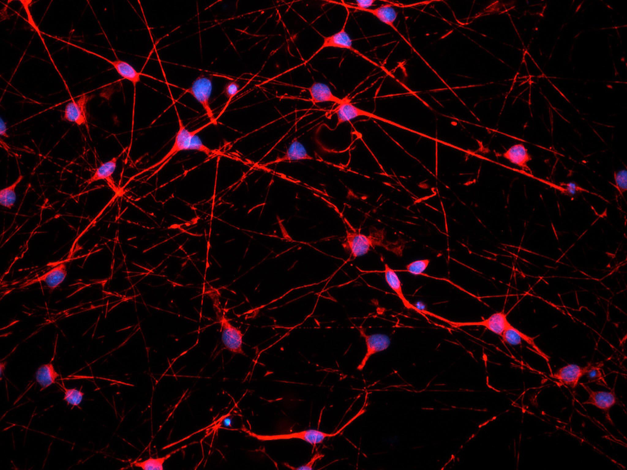 原代细胞培养（鉴定）