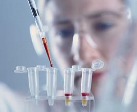 Anti-IL-28R抗体白细胞介素28受体抗体