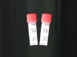 Anti-Destrin19/ADF抗体