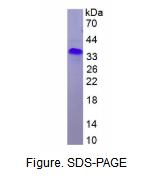 视网膜血管瘤肿瘤抑制因子(vHL)重组蛋白