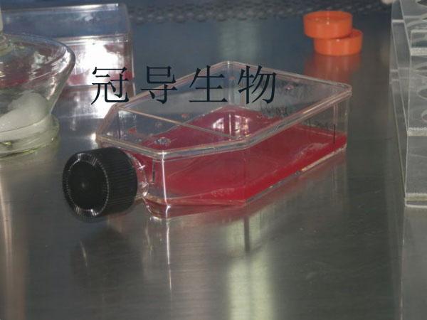 ETCC-007细胞|人乳腺导管癌细胞