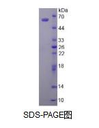 醛脱氢酶1家族成员A1(ALDH1A1)活性蛋白