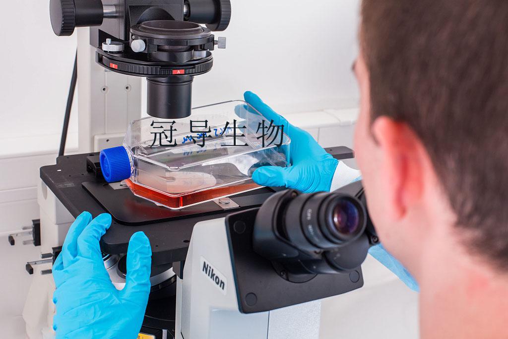 GAK 人类恶性黑色素瘤细胞