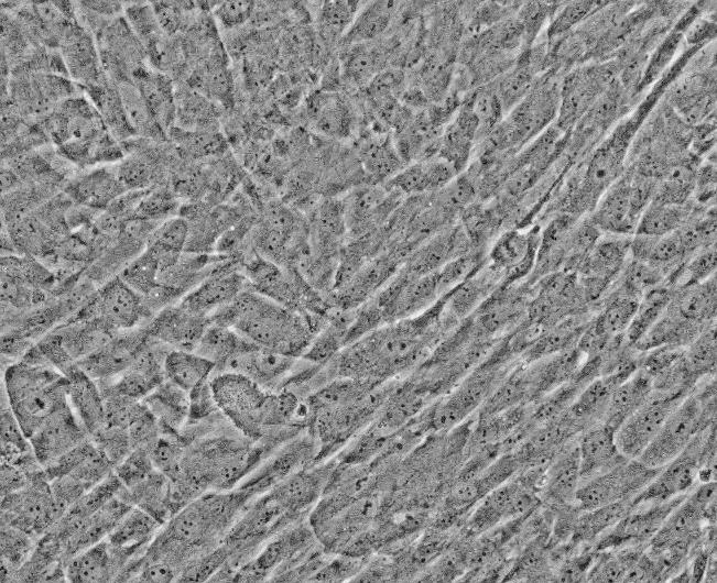 RAMOS人B淋巴细胞瘤细胞