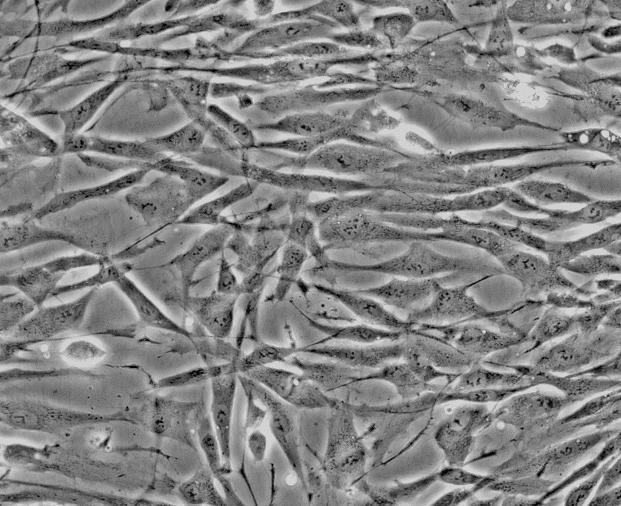 人脑动脉血管内皮细胞