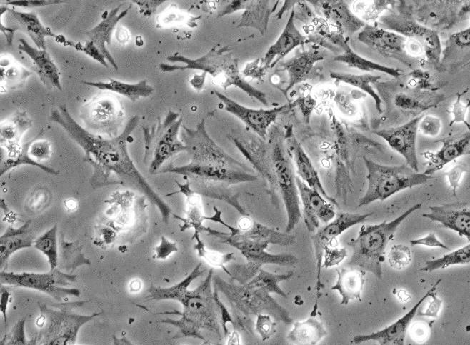 人视网膜色素上皮细胞