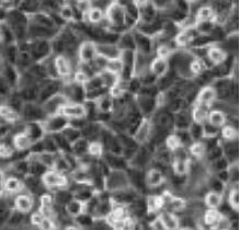 HKC细胞,人胚肾上皮细胞系