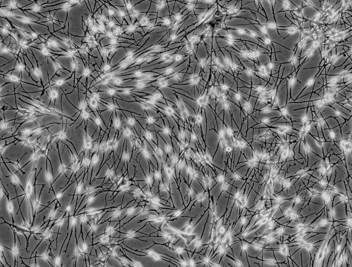 小鼠骨髓单核细胞 MBMMC