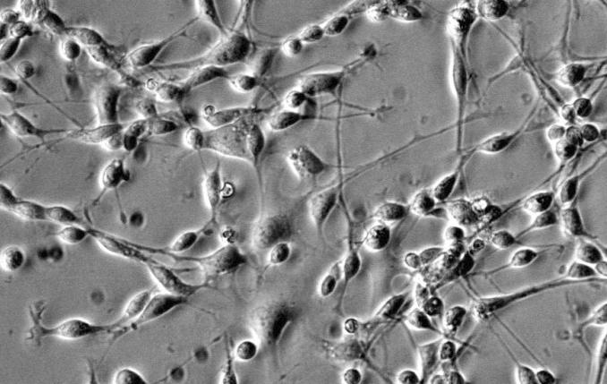 人膀胱移行细胞癌，UM-UC-3