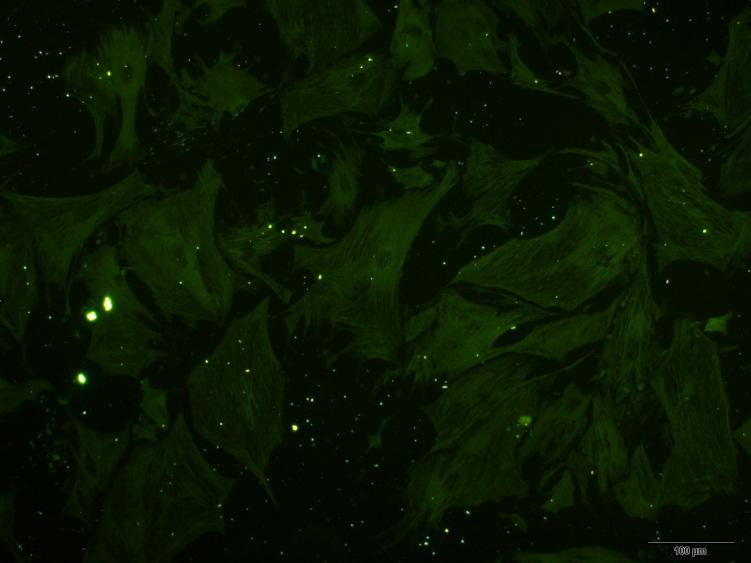 小鼠胰腺星状细胞