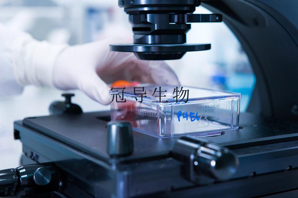 HSC/mHSC Cell Line||小鼠肝星状细胞系