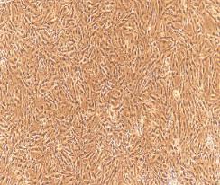 兔淋巴管内皮细胞