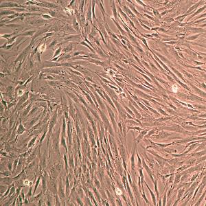 人骨髓间充质干细胞