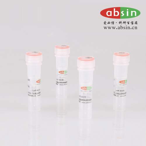 Rabbit anti-LDLR Polyclonal Antibody,LDLR抗体