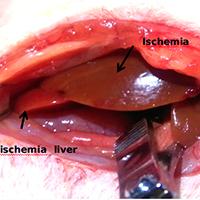 2/3肝缺血再灌注动物模型